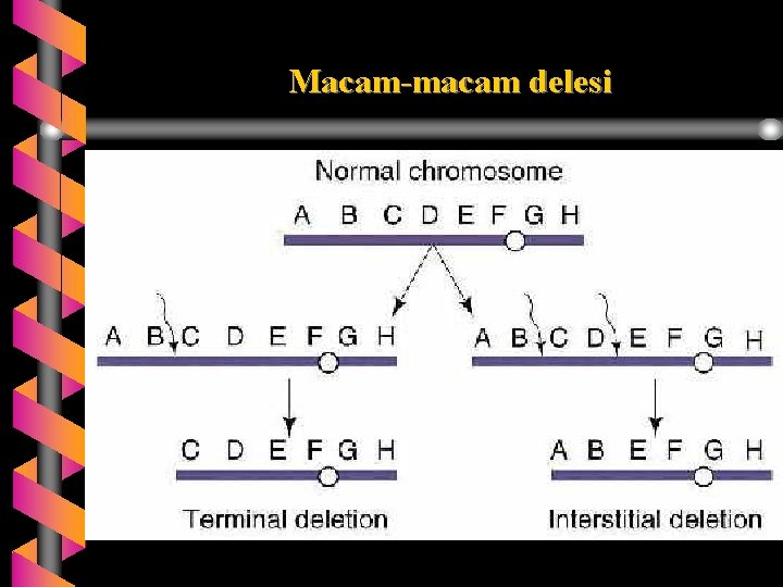 Macam-macam delesi 