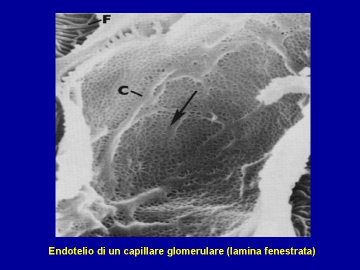Endotelio di un capillare glomerulare (lamina fenestrata) 