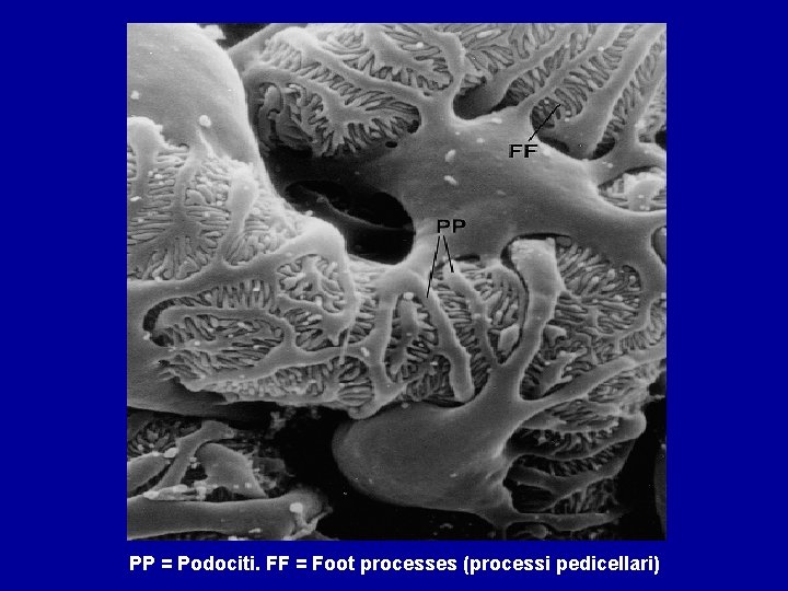 PP = Podociti. FF = Foot processes (processi pedicellari) 