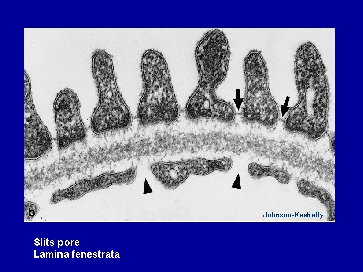 Johnson-Feehally Slits pore Lamina fenestrata 