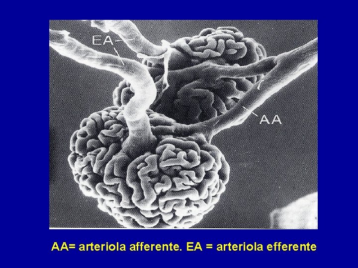 AA= arteriola afferente. EA = arteriola efferente 