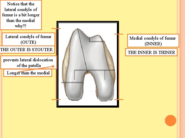 Notice that the lateral condyle of femur is a bit longer than the medial