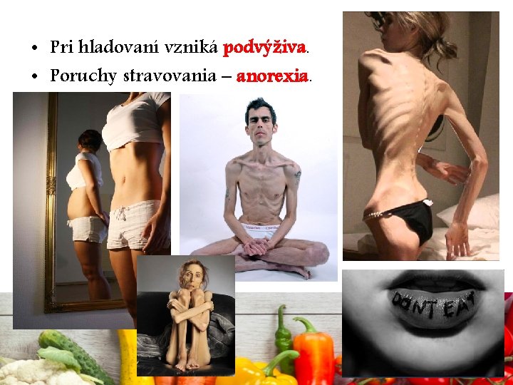  • Pri hladovaní vzniká podvýživa. • Poruchy stravovania – anorexia. 