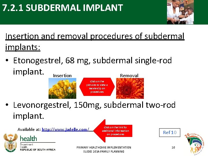 7. 2. 1 SUBDERMAL IMPLANT Insertion and removal procedures of subdermal implants: • Etonogestrel,