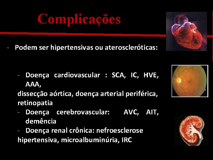 Complicações - Podem ser hipertensivas ou ateroscleróticas: - Doença cardiovascular : SCA, IC, HVE,