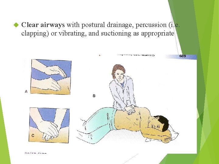  Clear airways with postural drainage, percussion (i. e. clapping) or vibrating, and suctioning