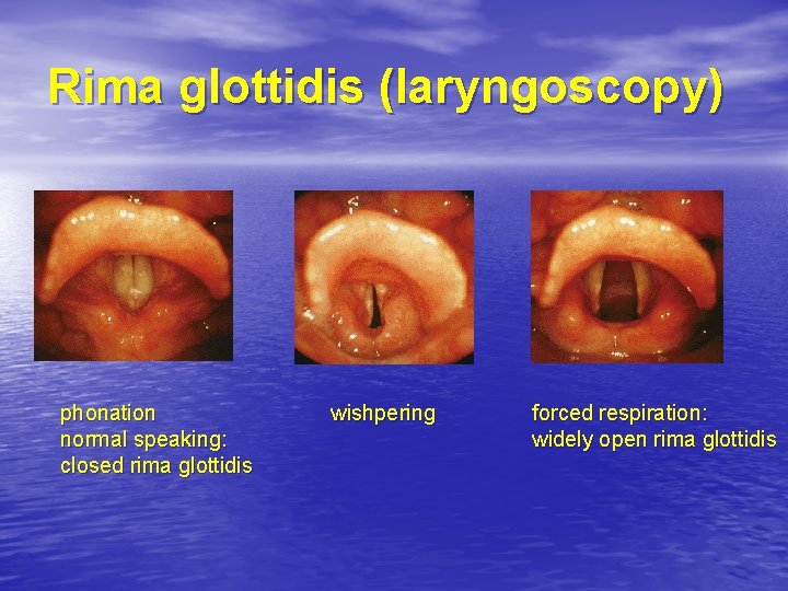 Rima glottidis (laryngoscopy) phonation normal speaking: closed rima glottidis wishpering forced respiration: widely open