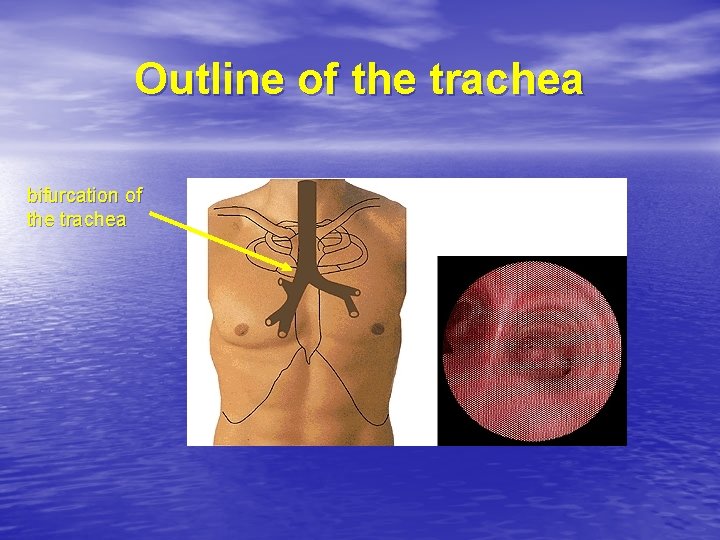 Outline of the trachea bifurcation of the trachea 