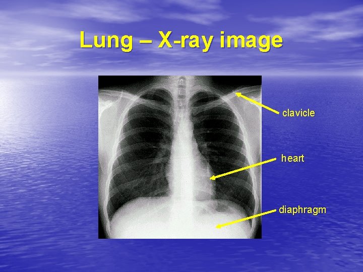 Lung – X-ray image clavicle heart diaphragm 