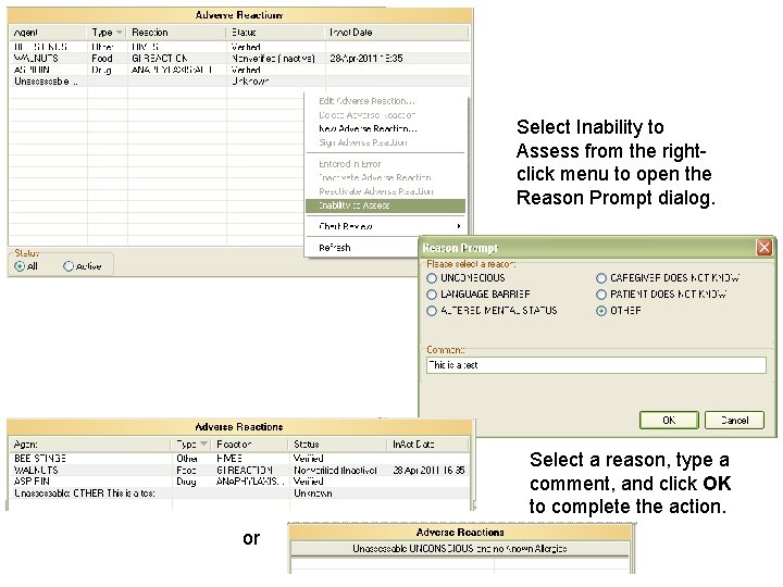 Select Inability to Assess from the rightclick menu to open the Reason Prompt dialog. Select Inability to Assess from the rightclick menu to open the Reason Prompt dialog.