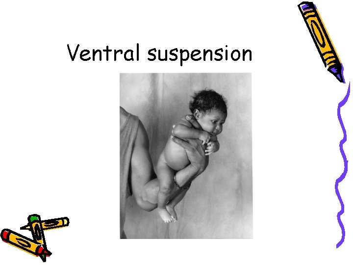 Ventral suspension 