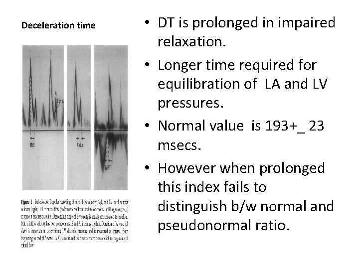 Deceleration time • DT is prolonged in impaired relaxation. • Longer time required for