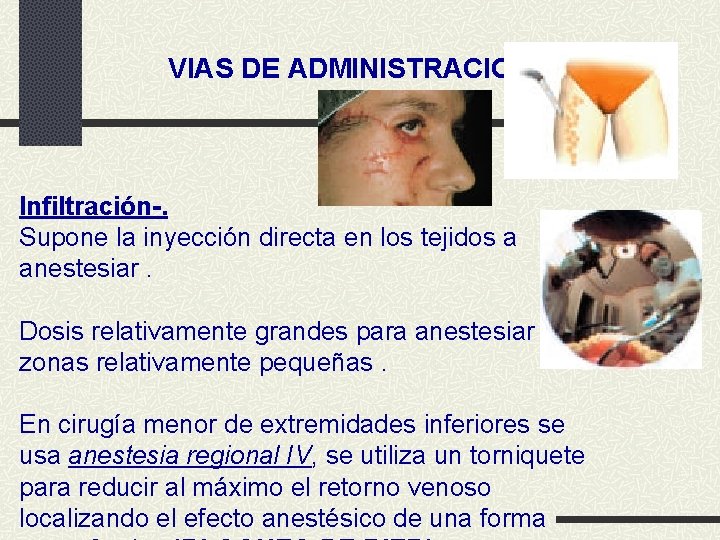 VIAS DE ADMINISTRACION Infiltración-. Supone la inyección directa en los tejidos a anestesiar. Dosis