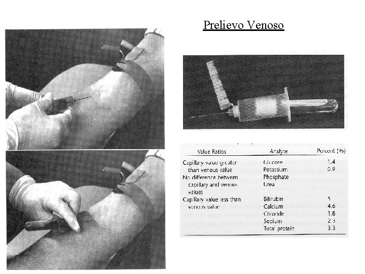 Prelievo Venoso 