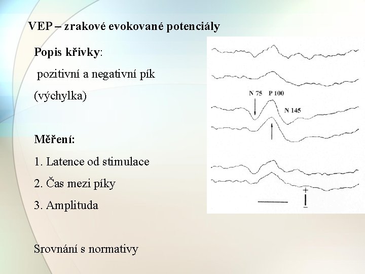 VEP – zrakové evokované potenciály Popis křivky: pozitivní a negativní pík (výchylka) Měření: 1.