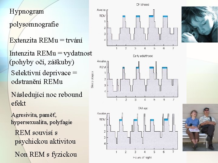 Hypnogram polysomnografie Extenzita REMu = trvání Intenzita REMu = vydatnost (pohyby očí, záškuby) Selektivní