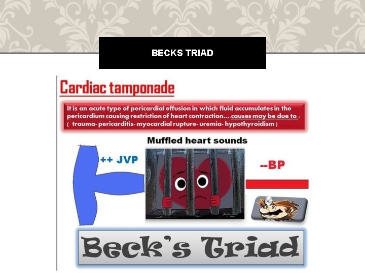 BECKS TRIAD 