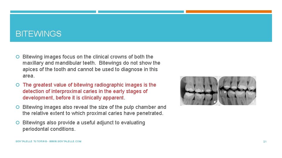 BITEWINGS Bitewing images focus on the clinical crowns of both the maxillary and mandibular