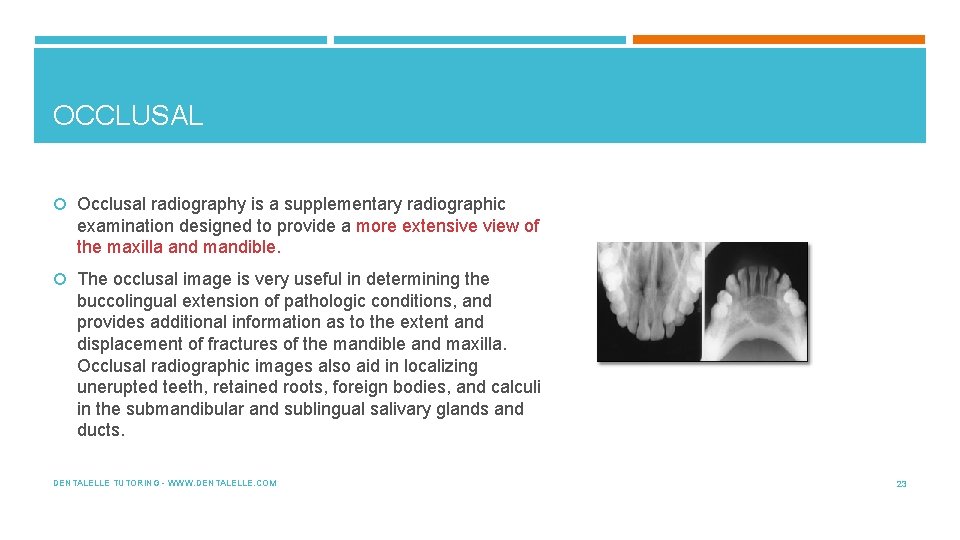 OCCLUSAL Occlusal radiography is a supplementary radiographic examination designed to provide a more extensive