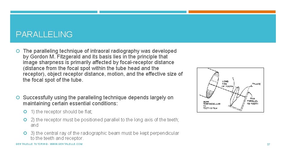 PARALLELING The paralleling technique of intraoral radiography was developed by Gordon M. Fitzgerald and