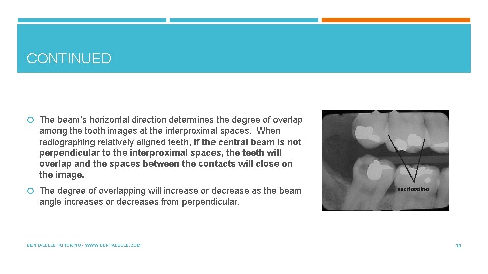 CONTINUED The beam’s horizontal direction determines the degree of overlap among the tooth images