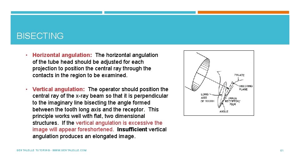 BISECTING • Horizontal angulation: The horizontal angulation of the tube head should be adjusted