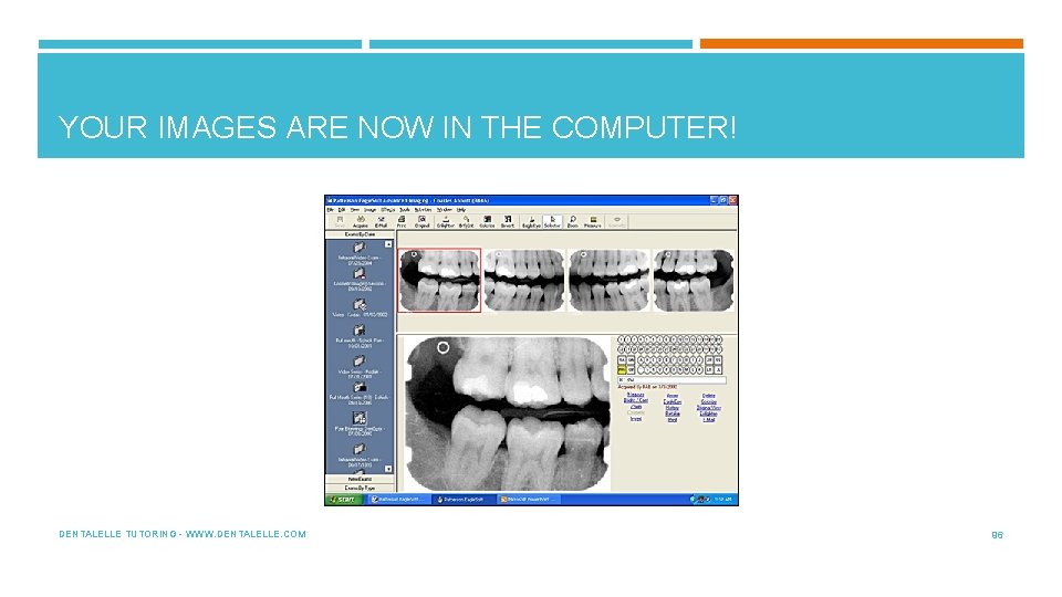 YOUR IMAGES ARE NOW IN THE COMPUTER! DENTALELLE TUTORING - WWW. DENTALELLE. COM 96