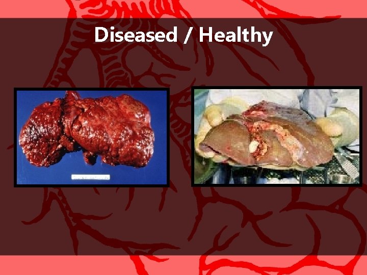 Diseased / Healthy 