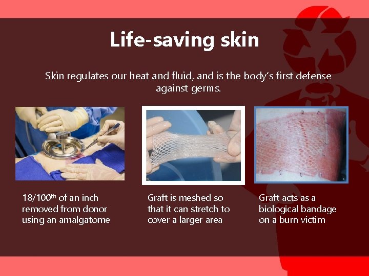 Life-saving skin Skin regulates our heat and fluid, and is the body’s first defense