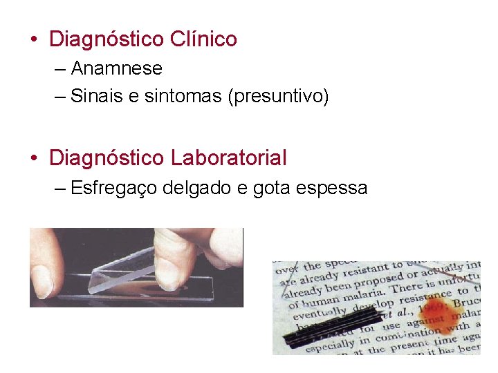  • Diagnóstico Clínico – Anamnese – Sinais e sintomas (presuntivo) • Diagnóstico Laboratorial