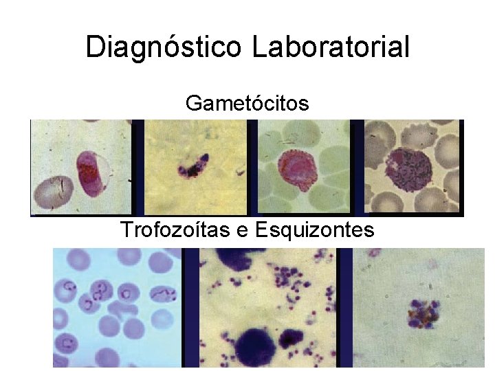 Diagnóstico Laboratorial Gametócitos Trofozoítas e Esquizontes 