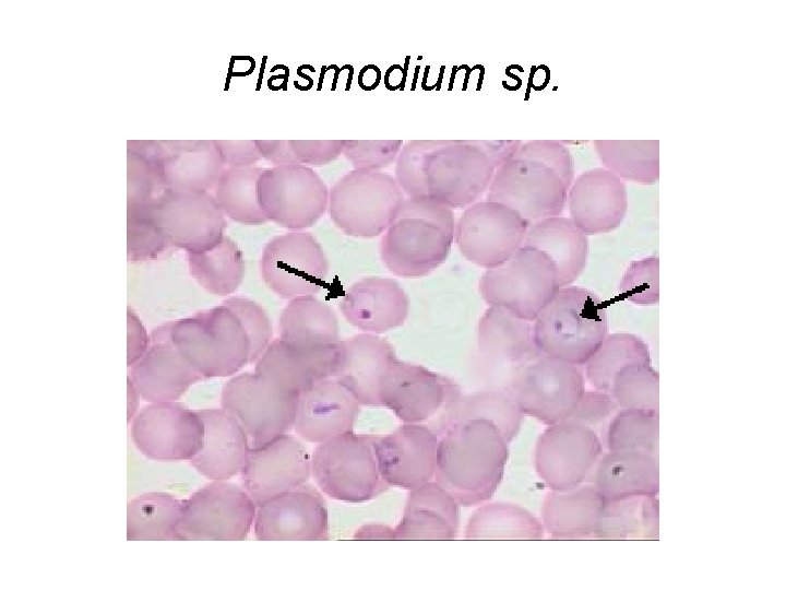 Plasmodium sp. 