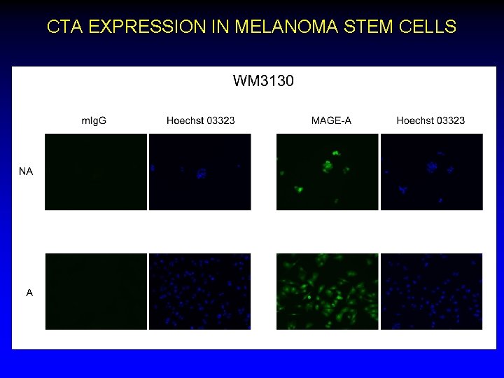 CTA EXPRESSION IN MELANOMA STEM CELLS 
