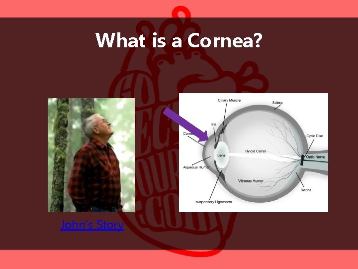 What is a Cornea? John’s Story 