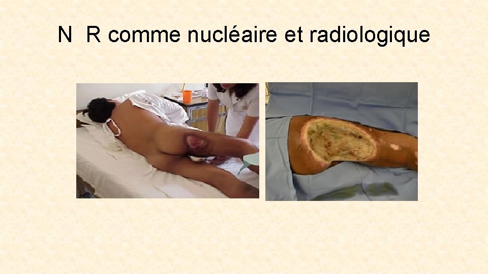 N R comme nucléaire et radiologique 