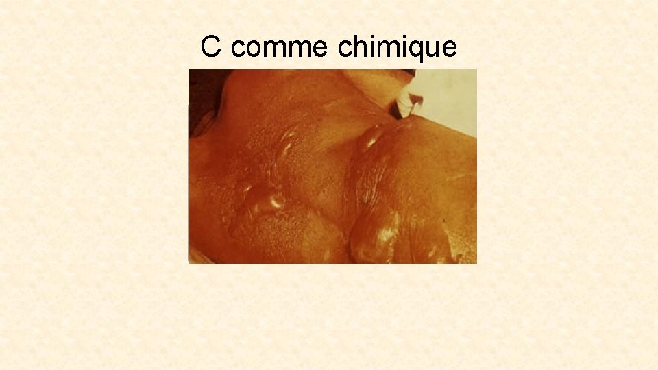 C comme chimique 