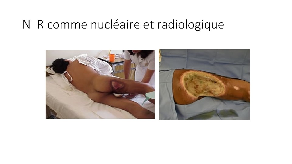 N R comme nucléaire et radiologique 