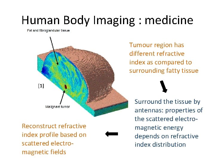 Human Body Imaging : medicine Tumour region has different refractive index as compared to