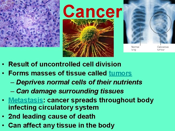 Cancer • Result of uncontrolled cell division • Forms masses of tissue called tumors