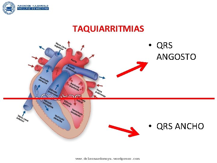 TAQUIARRITMIAS • QRS ANGOSTO • QRS ANCHO www. drleonardomoya. wordpress. com 