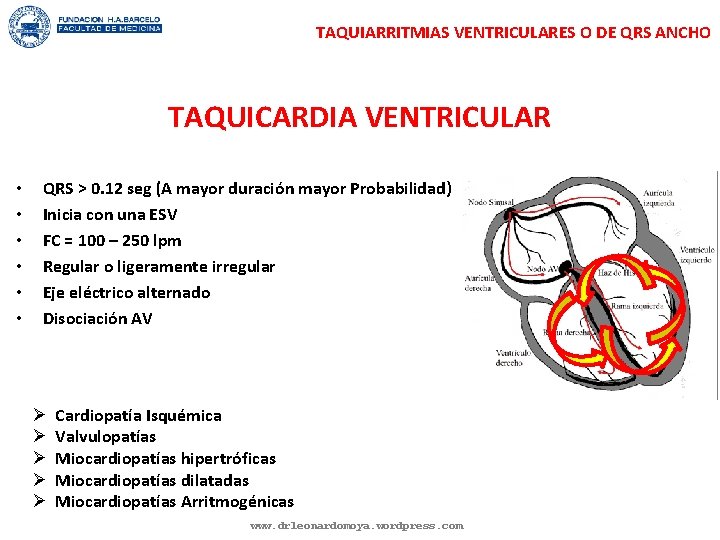 TAQUIARRITMIAS VENTRICULARES O DE QRS ANCHO TAQUICARDIA VENTRICULAR • • • QRS > 0.