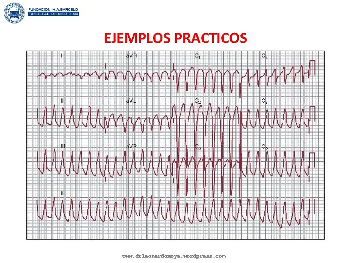 EJEMPLOS PRACTICOS www. drleonardomoya. wordpress. com 