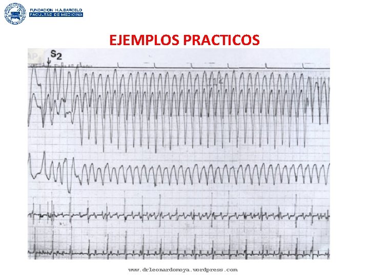 EJEMPLOS PRACTICOS www. drleonardomoya. wordpress. com 