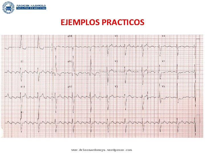 EJEMPLOS PRACTICOS www. drleonardomoya. wordpress. com 