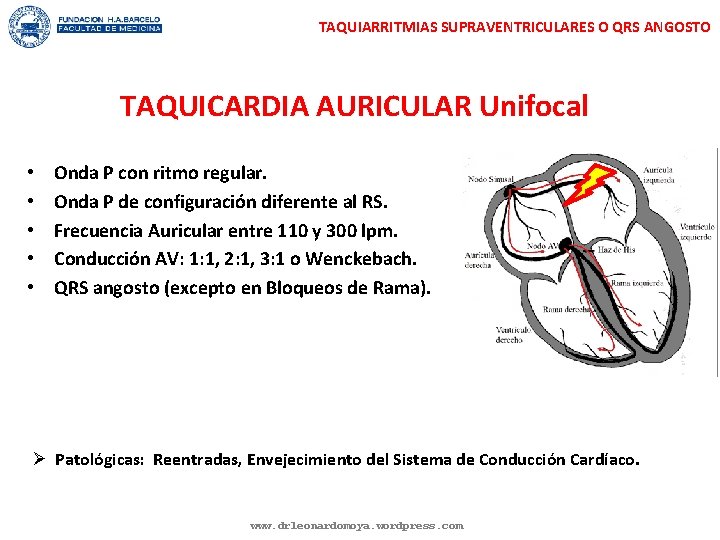 TAQUIARRITMIAS SUPRAVENTRICULARES O QRS ANGOSTO TAQUICARDIA AURICULAR Unifocal • • • Onda P con