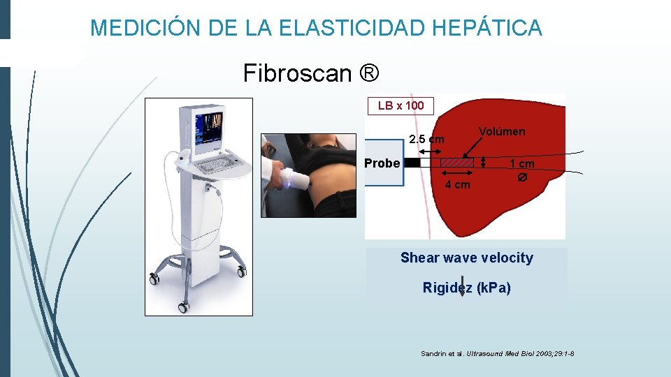 MEDICIÓN DE LA ELASTICIDAD HEPÁTICA Fibroscan ® LB x 100 Volúmen 2. 5 cm