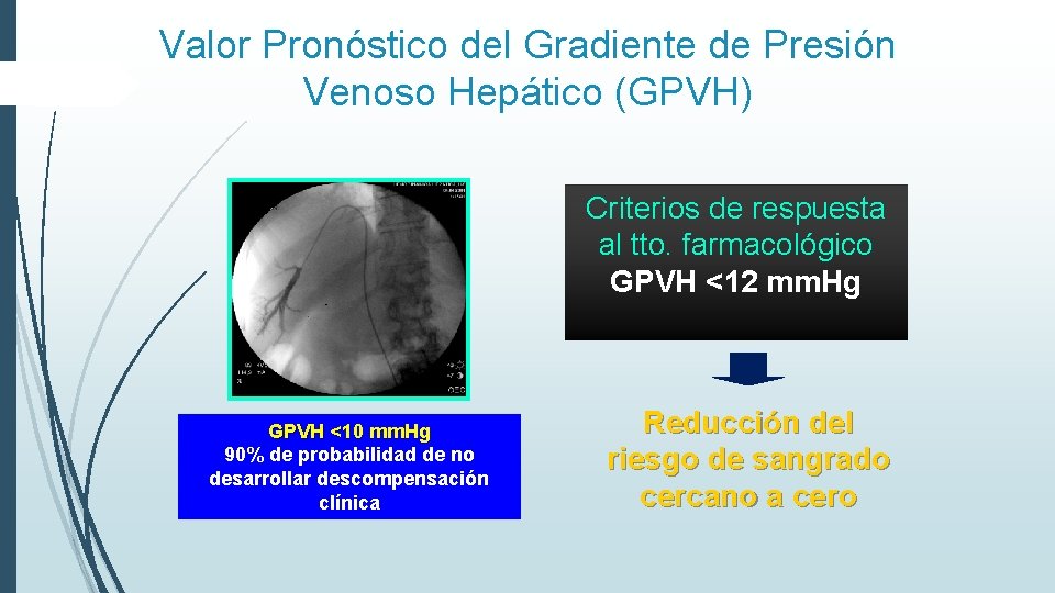 Valor Pronóstico del Gradiente de Presión Venoso Hepático (GPVH) Criterios de respuesta al tto.