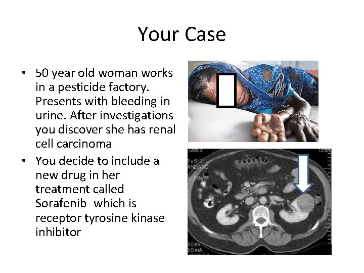 Your Case • 50 year old woman works in a pesticide factory. Presents with