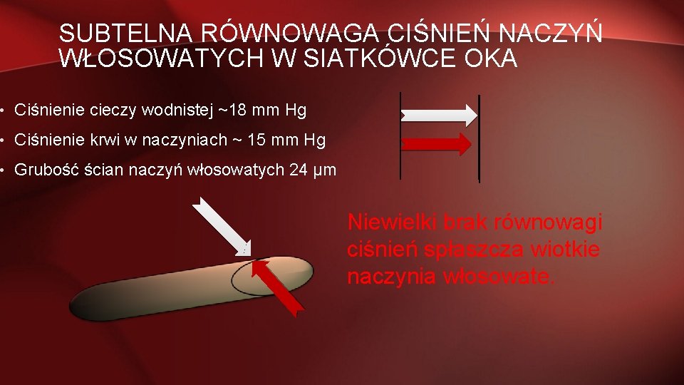 SUBTELNA RÓWNOWAGA CIŚNIEŃ NACZYŃ WŁOSOWATYCH W SIATKÓWCE OKA • Ciśnienie cieczy wodnistej ~18 mm