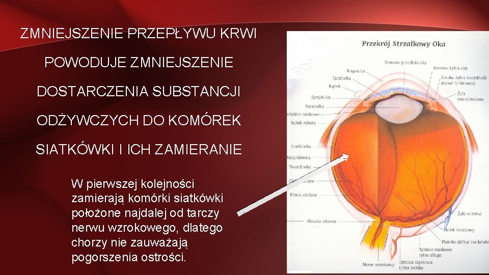 ZMNIEJSZENIE PRZEPŁYWU KRWI POWODUJE ZMNIEJSZENIE DOSTARCZENIA SUBSTANCJI ODŻYWCZYCH DO KOMÓREK SIATKÓWKI I ICH ZAMIERANIE